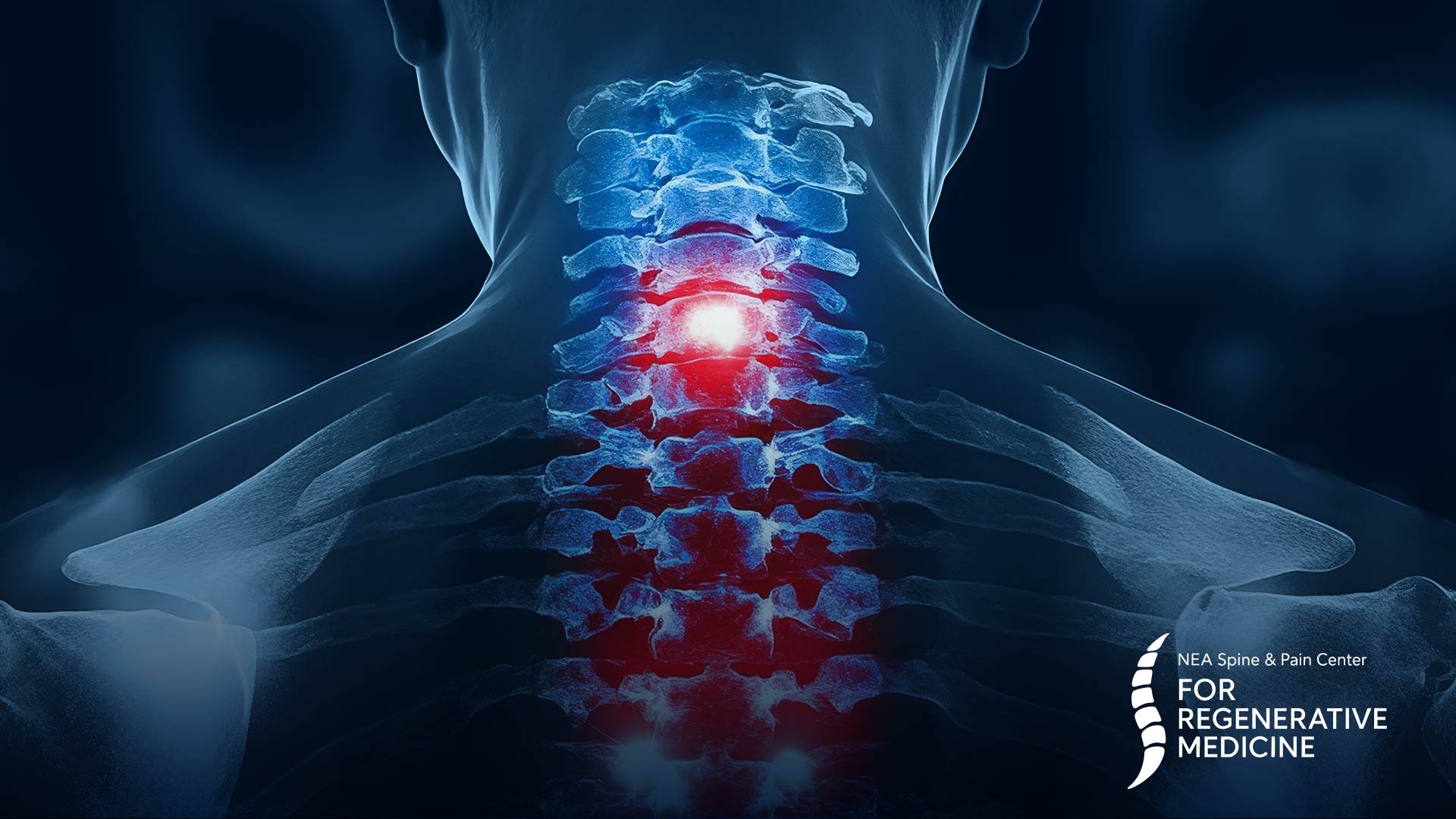 Understanding-Fibromyalgia