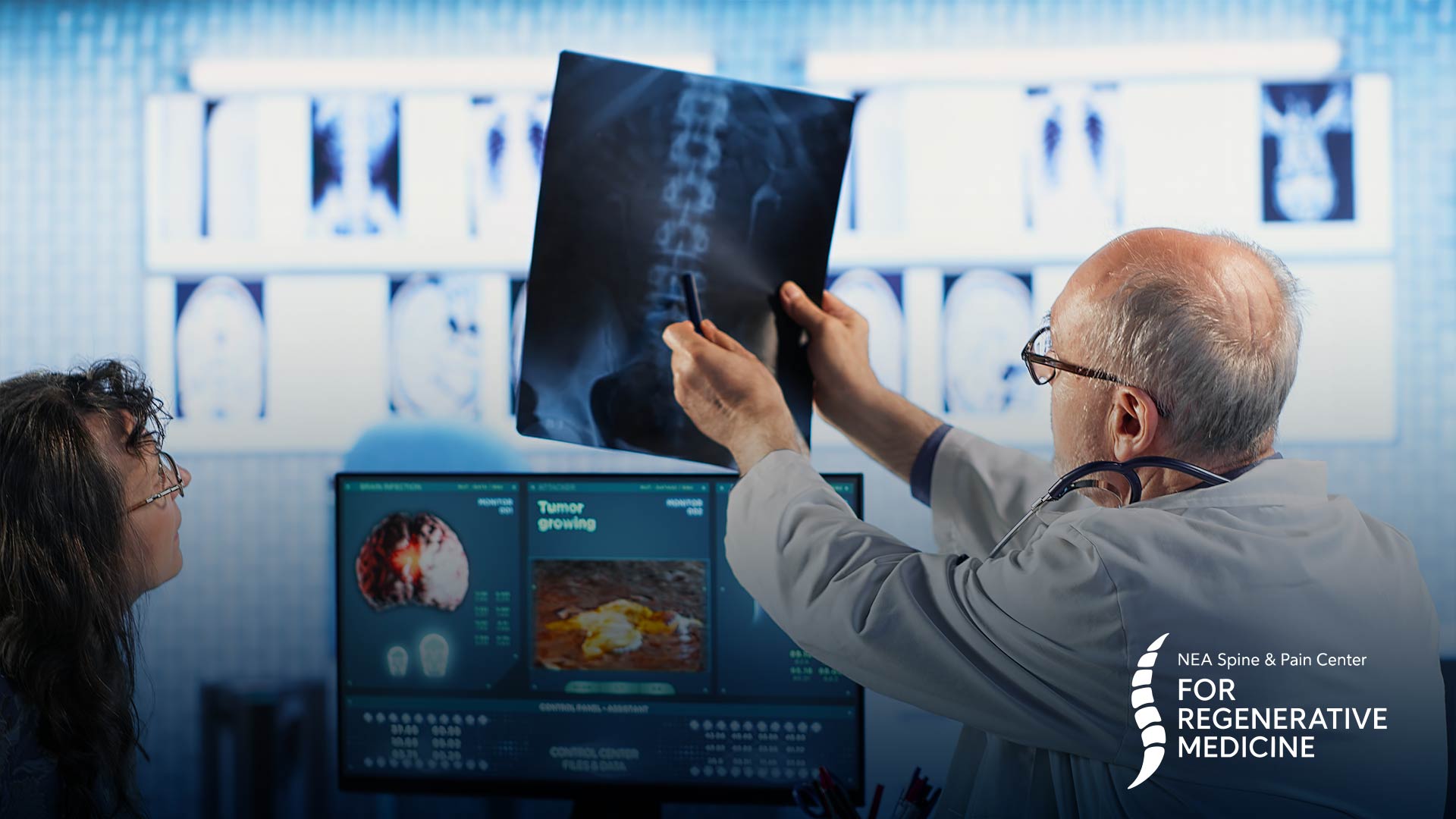 Basivertebral-nerve-ablation