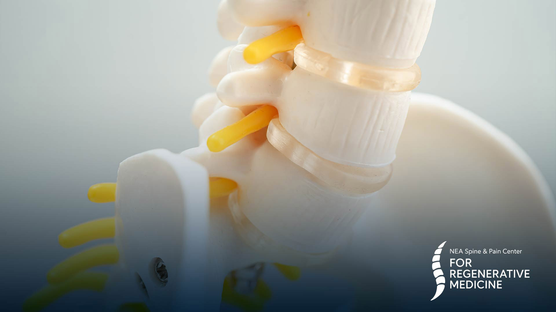 Facet-Joint-Injections-and-Medial-Branch-Blocks