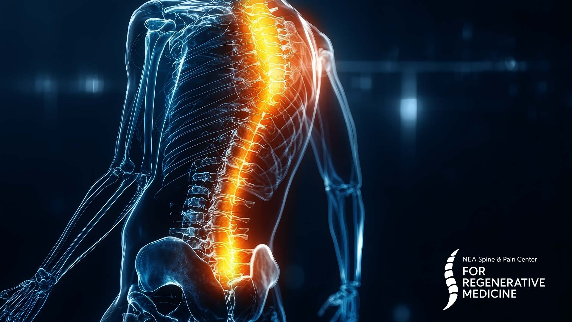 Facet-Joint-Injections-and-Medial-Branch-Blocks