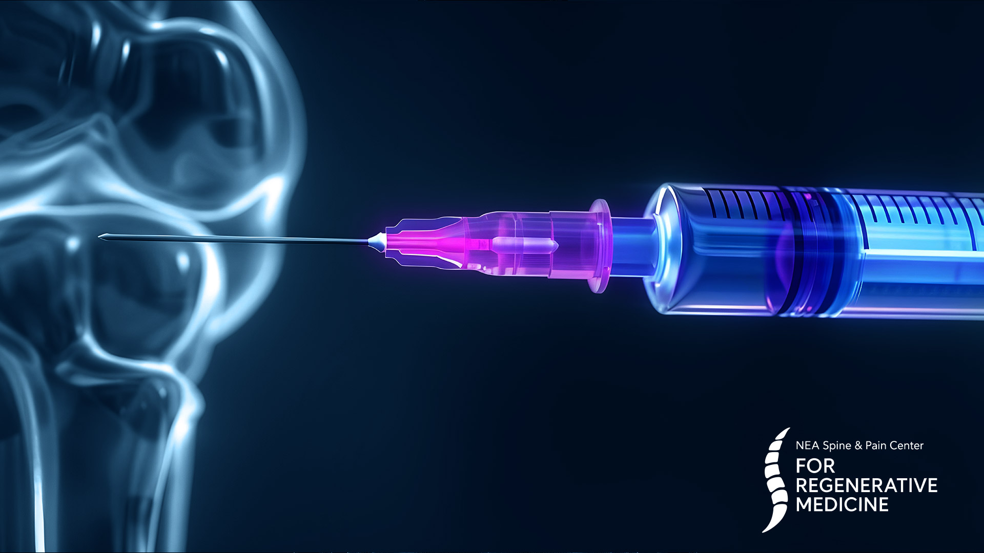Peripheral-joint-injections
