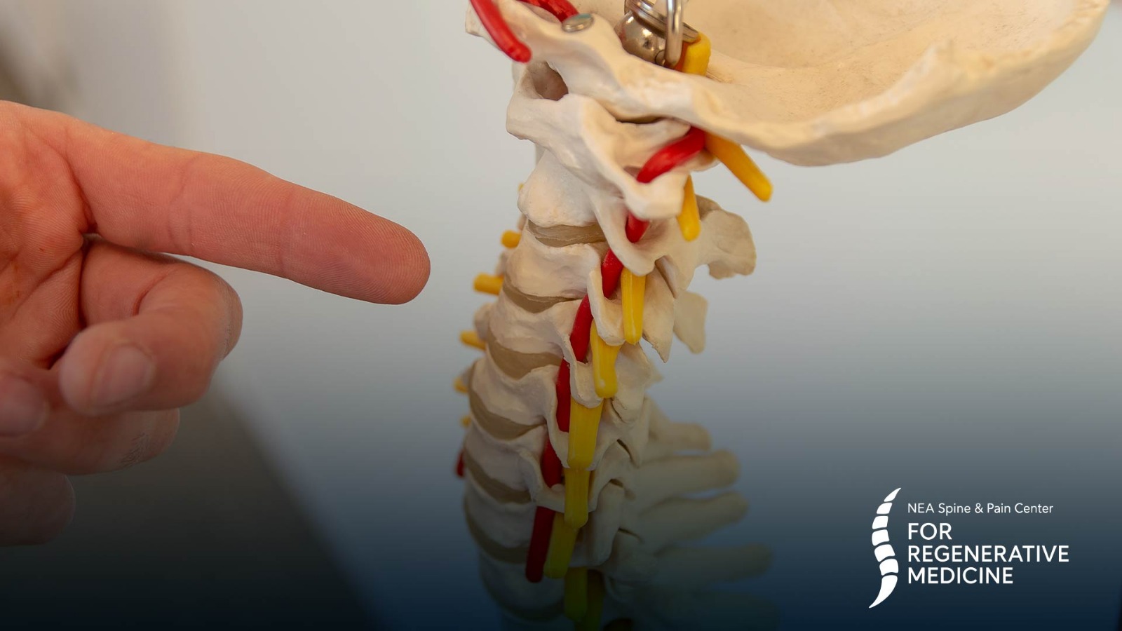 Spinal-Cord-Stimulator-Trial-and-Implantation